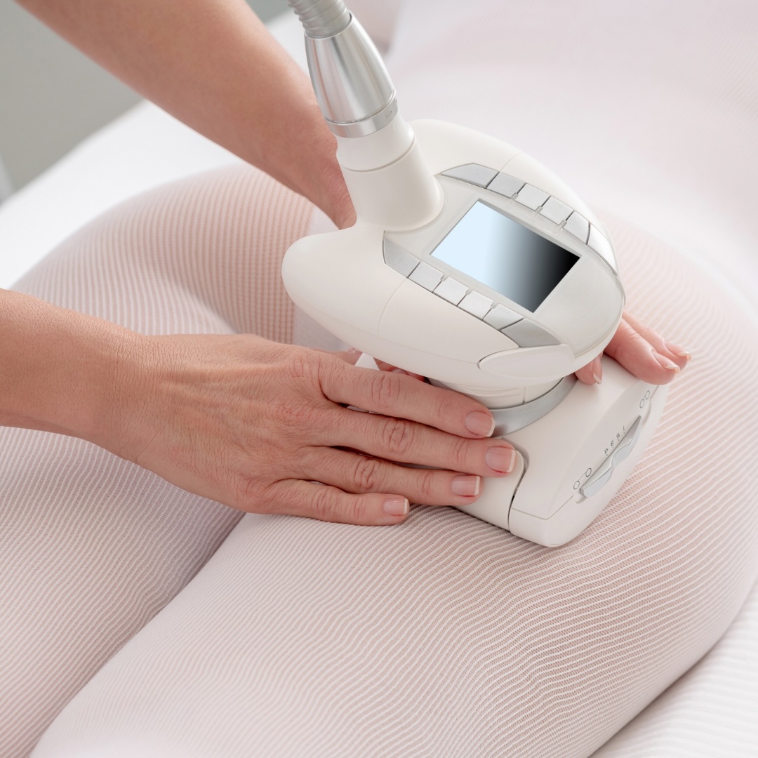 LPG Endermologie: beneficii, tratament și rezultate